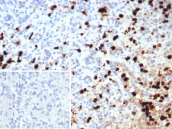 S100A9 Antibody / MRP14 / Calgranulin B / Calprotectin L1H