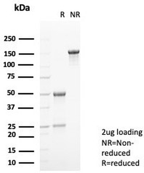 S100A9 Antibody / MRP14 / Calgranulin B / Calprotectin L1H