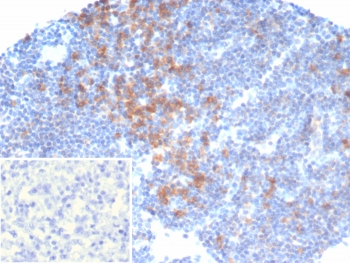 PI3KCD Antibody / PI3K delta / p110delta