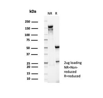 PI3KCD Antibody / PI3K delta / p110delta