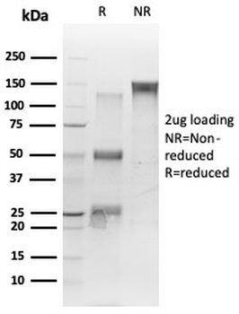 TDP43 Antibody / TARDBP / TAR DNA binding protein
