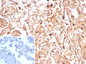 Podoplanin Antibody / PA2.26 antigen / Gp36