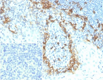 Gp36 Antibody / Glycoprotein 36 / Podoplanin