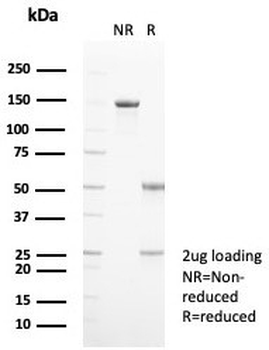 S100A9 Antibody / MRP14 / Calgranulin B / Calprotectin L1H