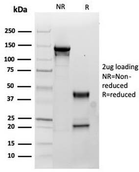 SDHB Antibody / Succinate dehydrogenase B