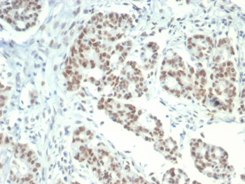 LSD1 Antibody / Lysine-Specific Demethylase 1