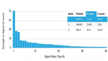 LSD1 Antibody / Lysine-Specific Demethylase 1
