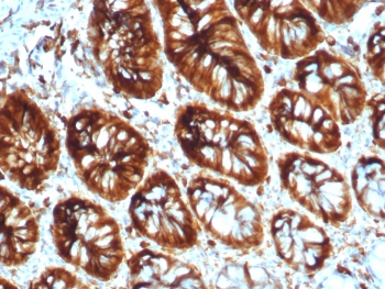 Stathmin 1 Antibody / Op18 / STMN1