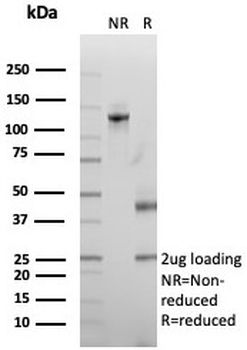 Stathmin 1 Antibody / Op18 / STMN1