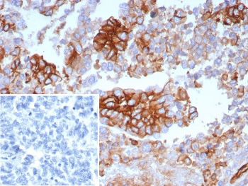 GLUT1 Antibody / SLC2A1
