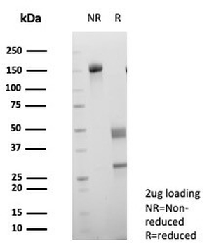 GLUT1 Antibody / SLC2A1
