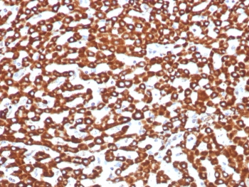 Recombinant Succinate dehydrogenase B Antibody / SDHB