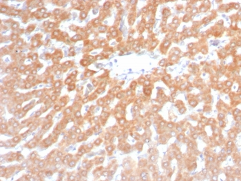 Recombinant SDHB Antibody / Succinate dehydrogenase B