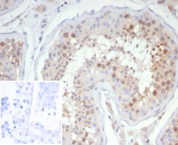 KIF2C Antibody / MCAK