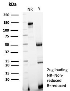 KIF2C Antibody / MCAK