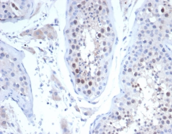 KIF2C Antibody / MCAK