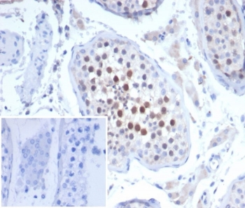 KIF2C Antibody / MCAK