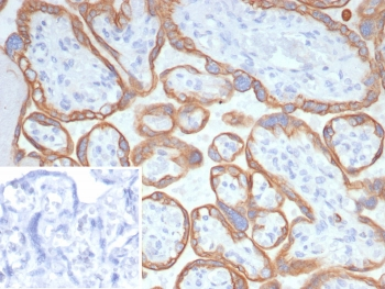 L1TD1 Antibody / ECAT11