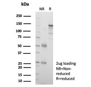 L1TD1 Antibody / ECAT11