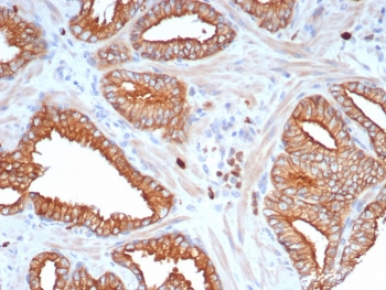 L1TD1 Antibody / ECAT11