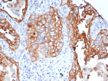 L1TD1 Antibody / ECAT11