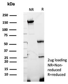 GBP1 Antibody / Guanylate binding protein 1