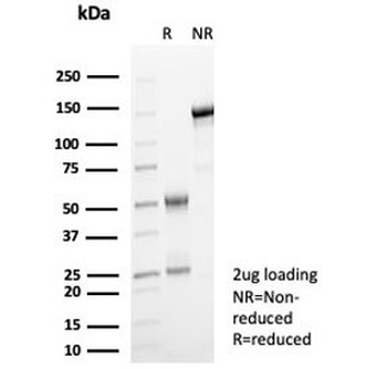 GBP1 Antibody / Guanylate binding protein 1