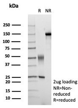 GCLM Antibody / Glutamate-Cysteine Ligase Regulatory Subunit