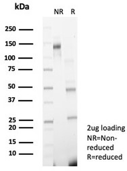 GCLM Antibody / Glutamate-Cysteine Ligase Regulatory Subunit
