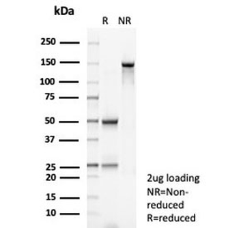 GSTM3 Antibody / Glutathione S-Transferase mu 3