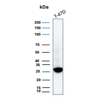 GSTM3 Antibody / Glutathione S-Transferase mu 3