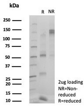 ZNF495 Antibody / ZSCAN5A