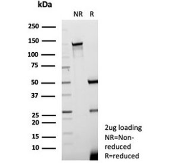 Kallikrein 7 Antibody / KLK7