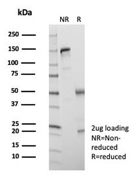 KIF2C Antibody / MCAK