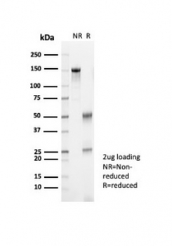 Kallikrein 7 Antibody / KLK7