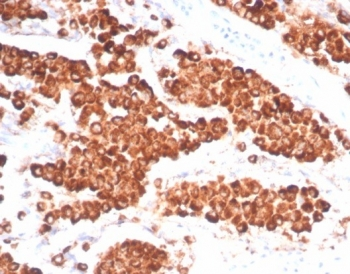Napsin A Antibody