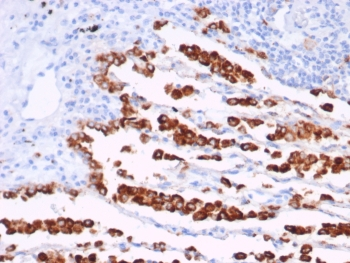 Recombinant NAPSA Antibody / Napsin A