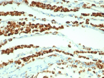 Recombinant NAPSA Antibody / Napsin A