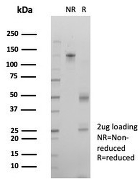Interferon regulatory factor 3 Antibody / IRF3