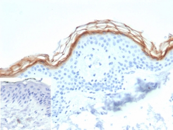Kallikrein 7 Antibody / KLK7