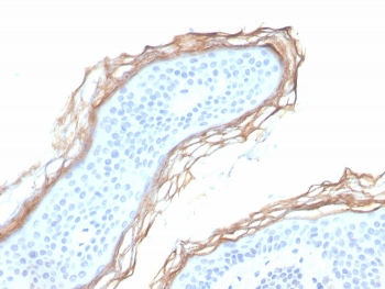 Kallikrein 5 Antibody / KLK5