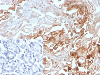 CEACAM1 Antibody / BGP-1