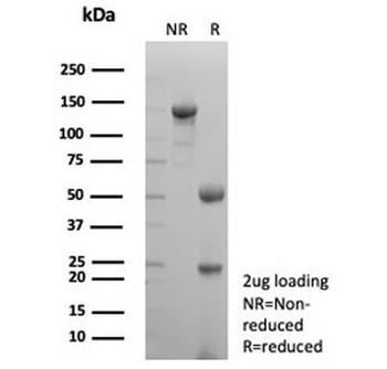Uroplakin 3B Antibody / UPK3B