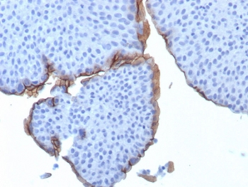 Uroplakin 3B Antibody / UPK3B
