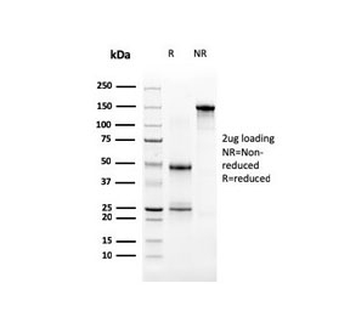 Uroplakin 3B Antibody / UPK3B