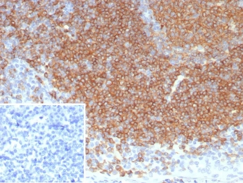 CD22 / BL-CAM Antibody