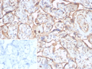 TGF beta Antibody / TGFB