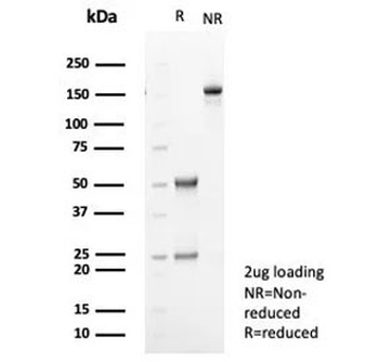 TGF beta Antibody / TGFB