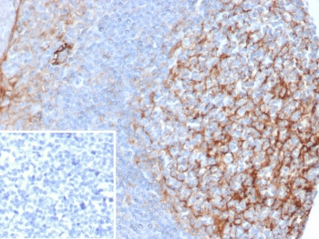 ICAM1 Antibody / CD54