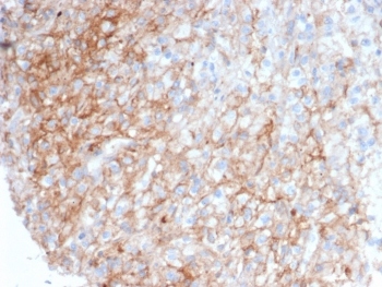 ICAM1 Antibody / CD54